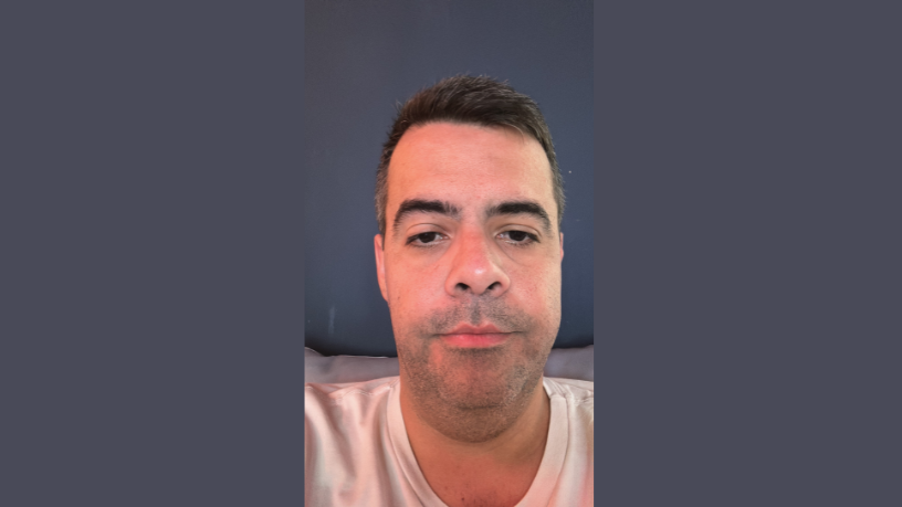 Ao abordar a importância do histórico clínico atualizado, Vinicius Tadeu Sattin Rodrigues reforça que a análise comparativa de mamografias anteriores é o pilar essencial para um diagnóstico mais preciso e seguro.